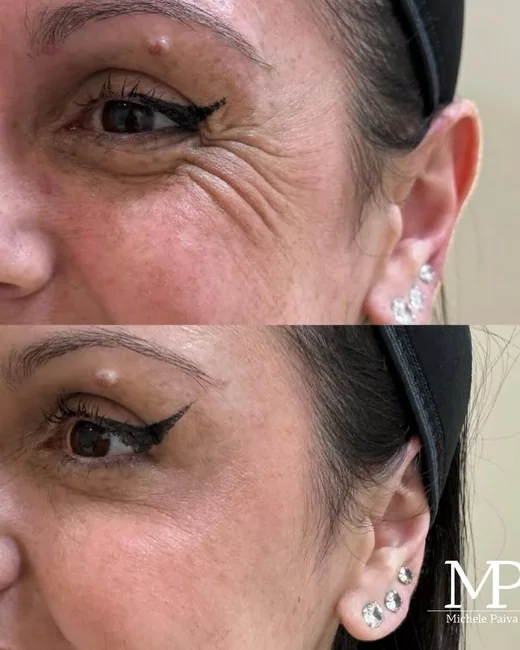 Resultado de estética facial 3