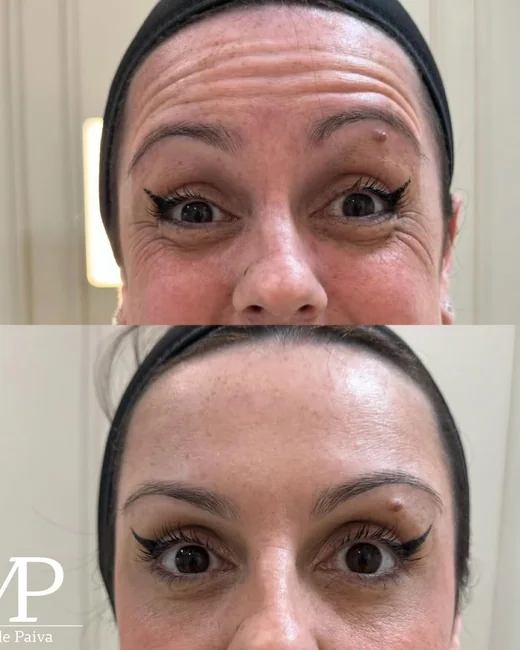 Resultado de estética facial 4