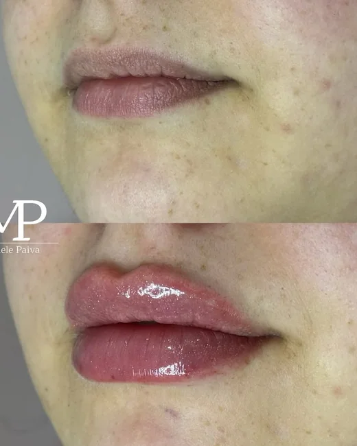 Resultado de estética facial 5