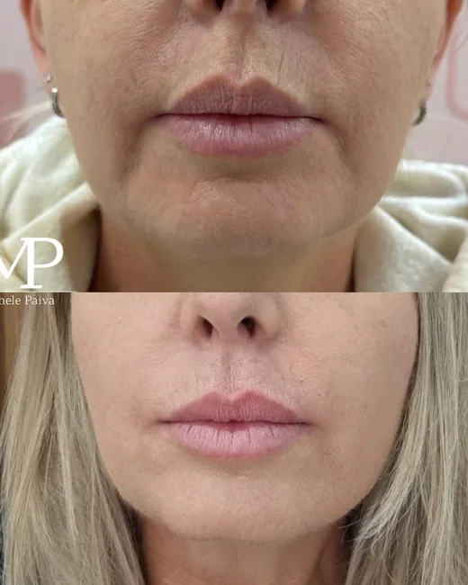 Resultado de estética facial 7