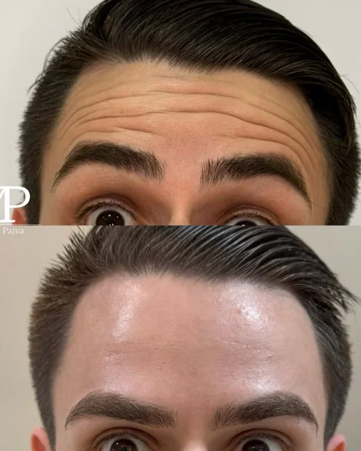 Resultado de estética facial 8