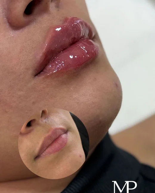 Resultado de estética facial 9