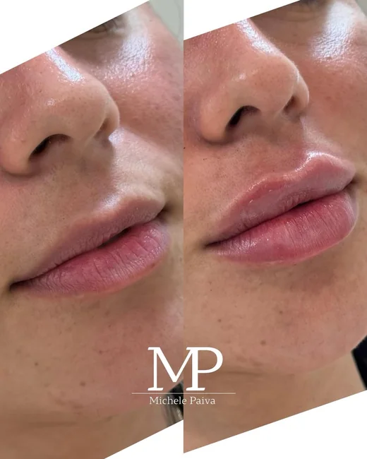 Resultado de estética facial 10