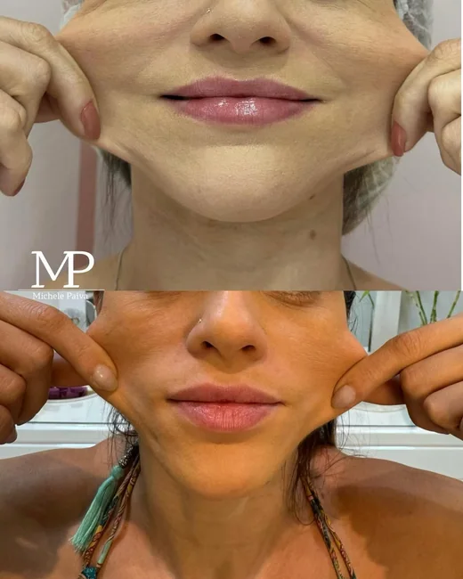 Resultado de estética facial 11