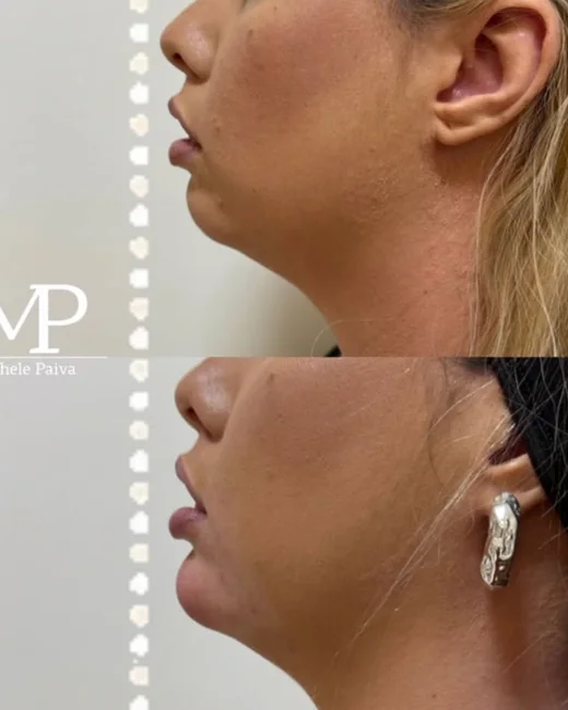 Resultado de estética facial 12