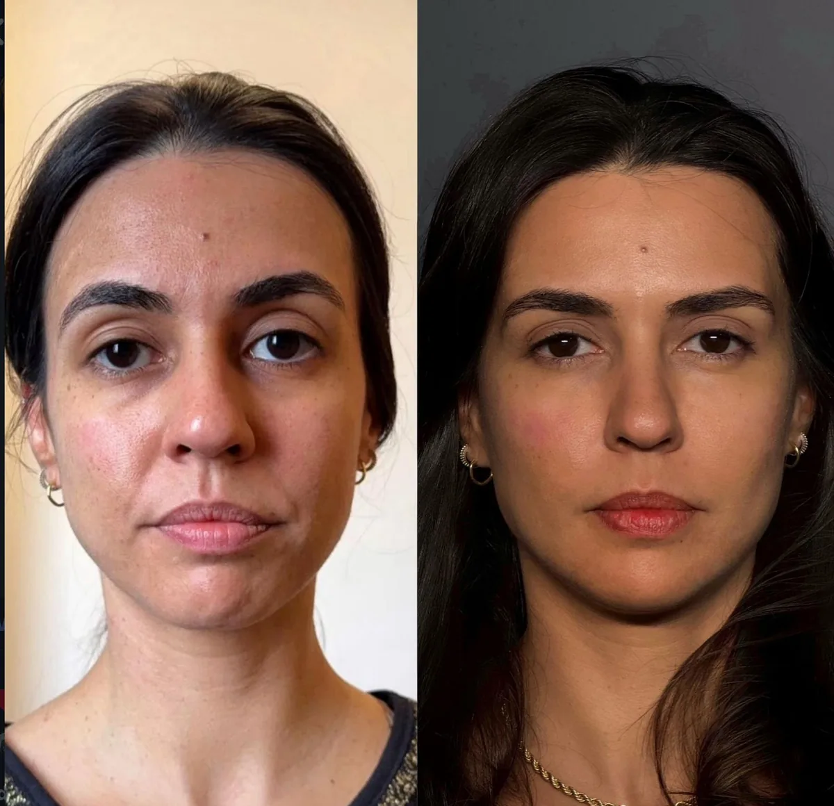 Caso 2: antes, à esquerda, e depois, à direita
